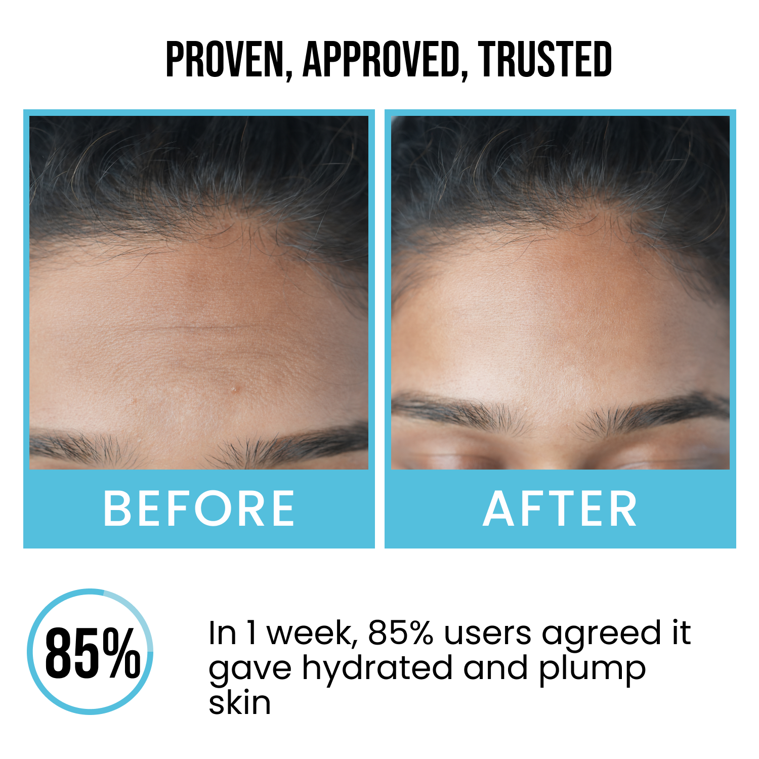 2% Hyaluronic Acid + 2% Alpha Arbutin Face Serum
