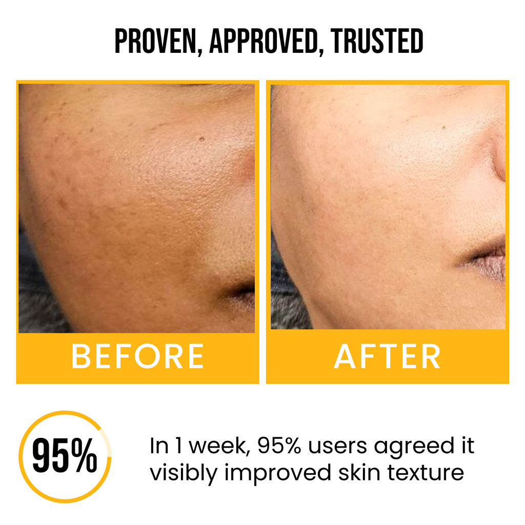 Tangerine Peel Clear Skin Face Serum