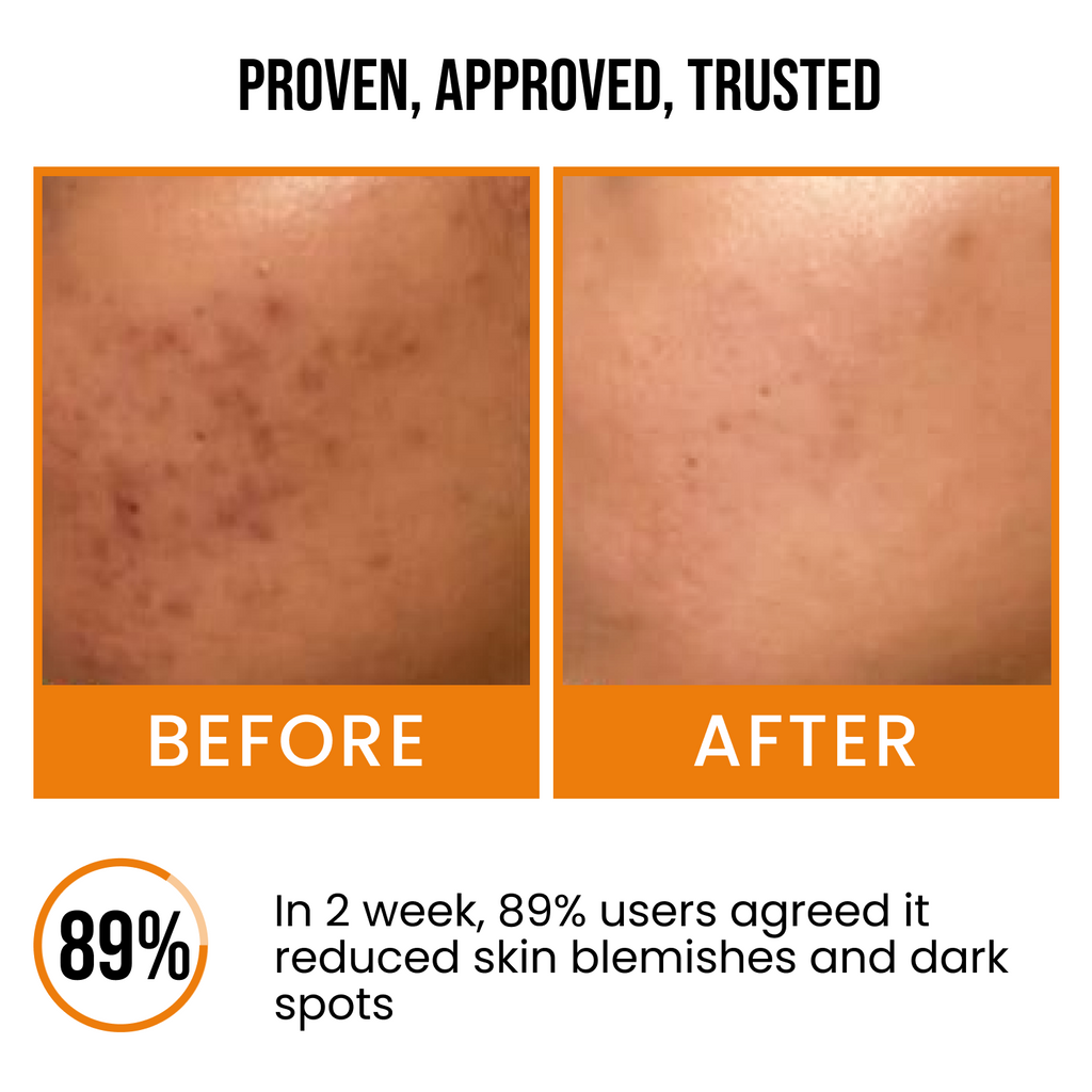 18% Vitamin C Skin Brightening Face Serum