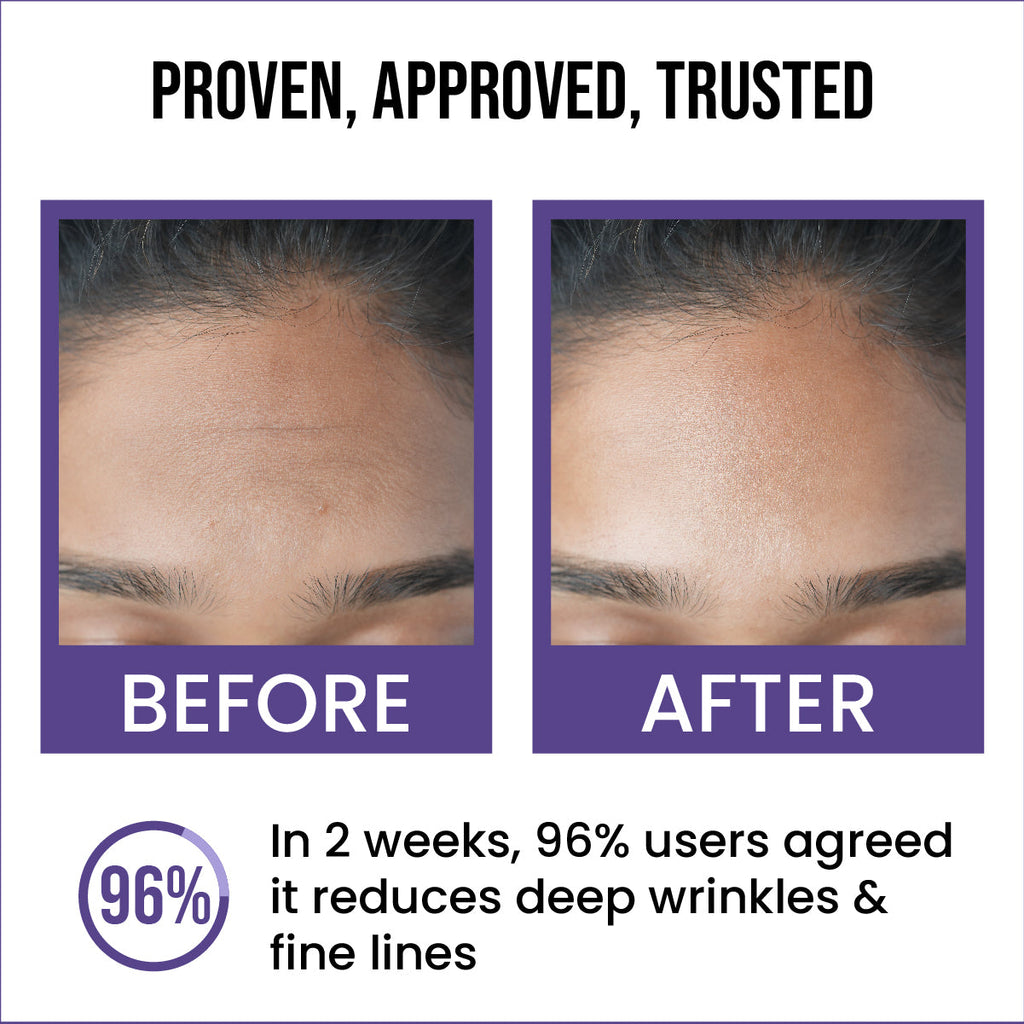 0.5% Retinol Anti-Ageing Face Serum
