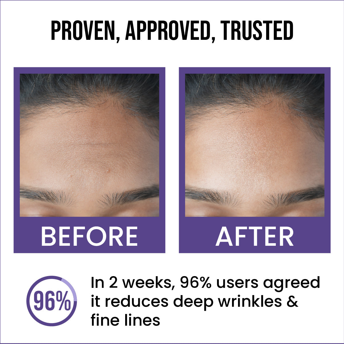 0.5% Retinol Anti-Ageing Face Serum