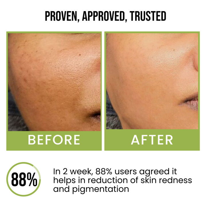 10% Niacinamide Vitamin C Face Serum