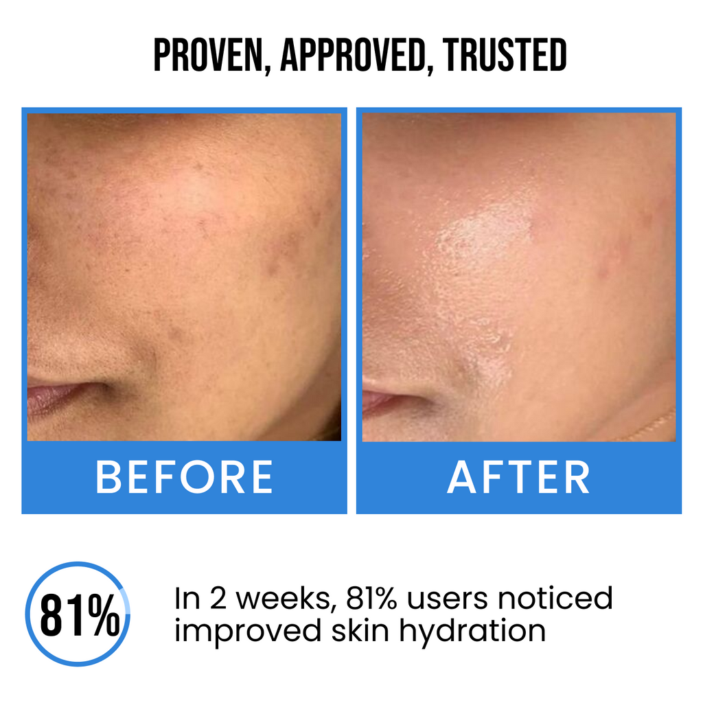 Ultra Hydrating Face Serum