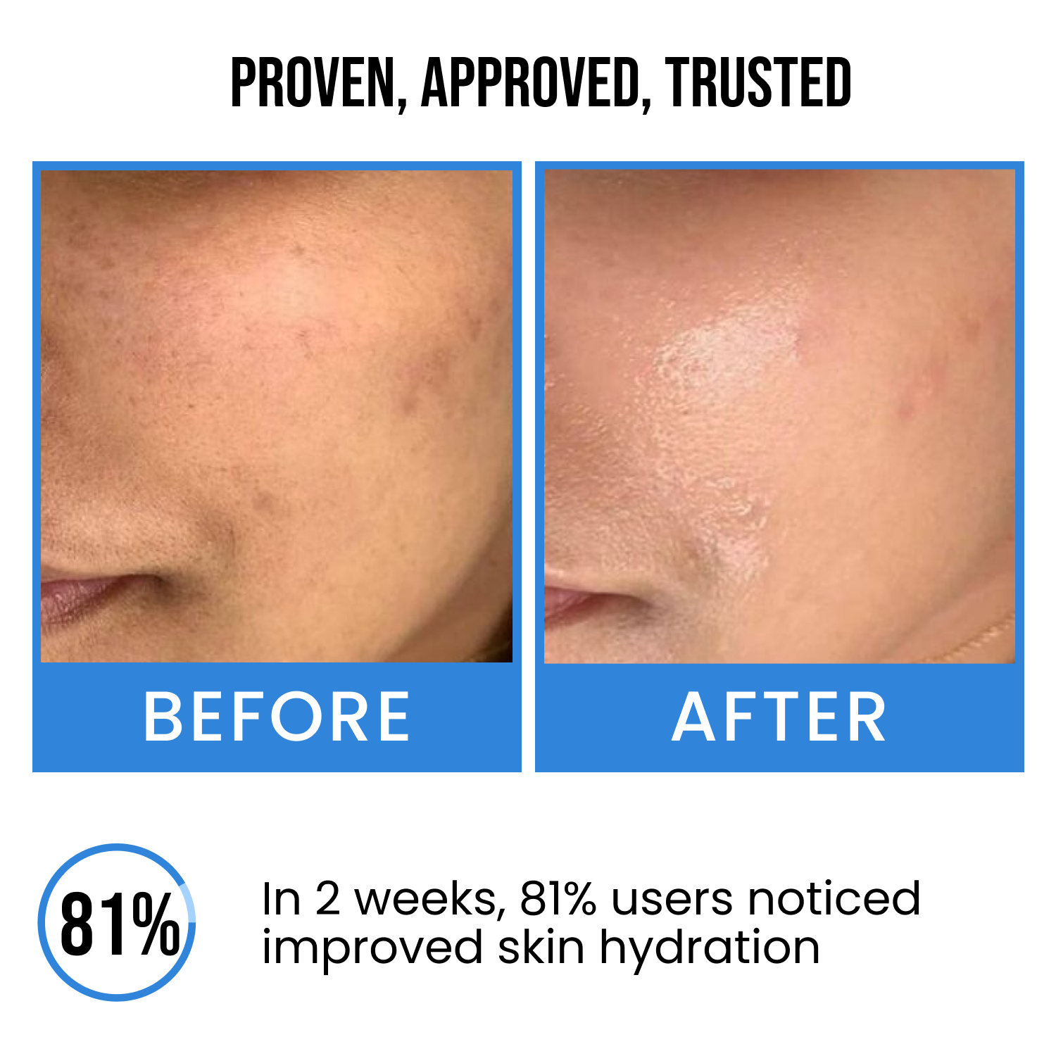 Ultra Hydrating Face Serum