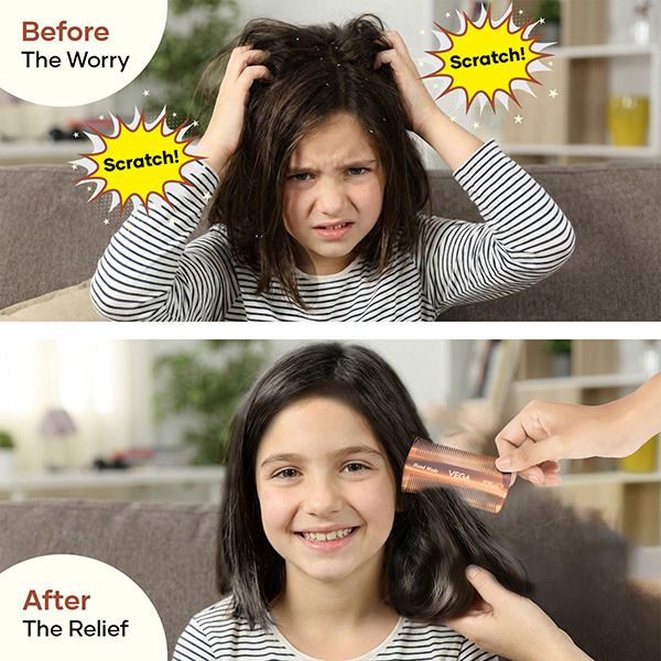 Lice Comb-HMC-37N