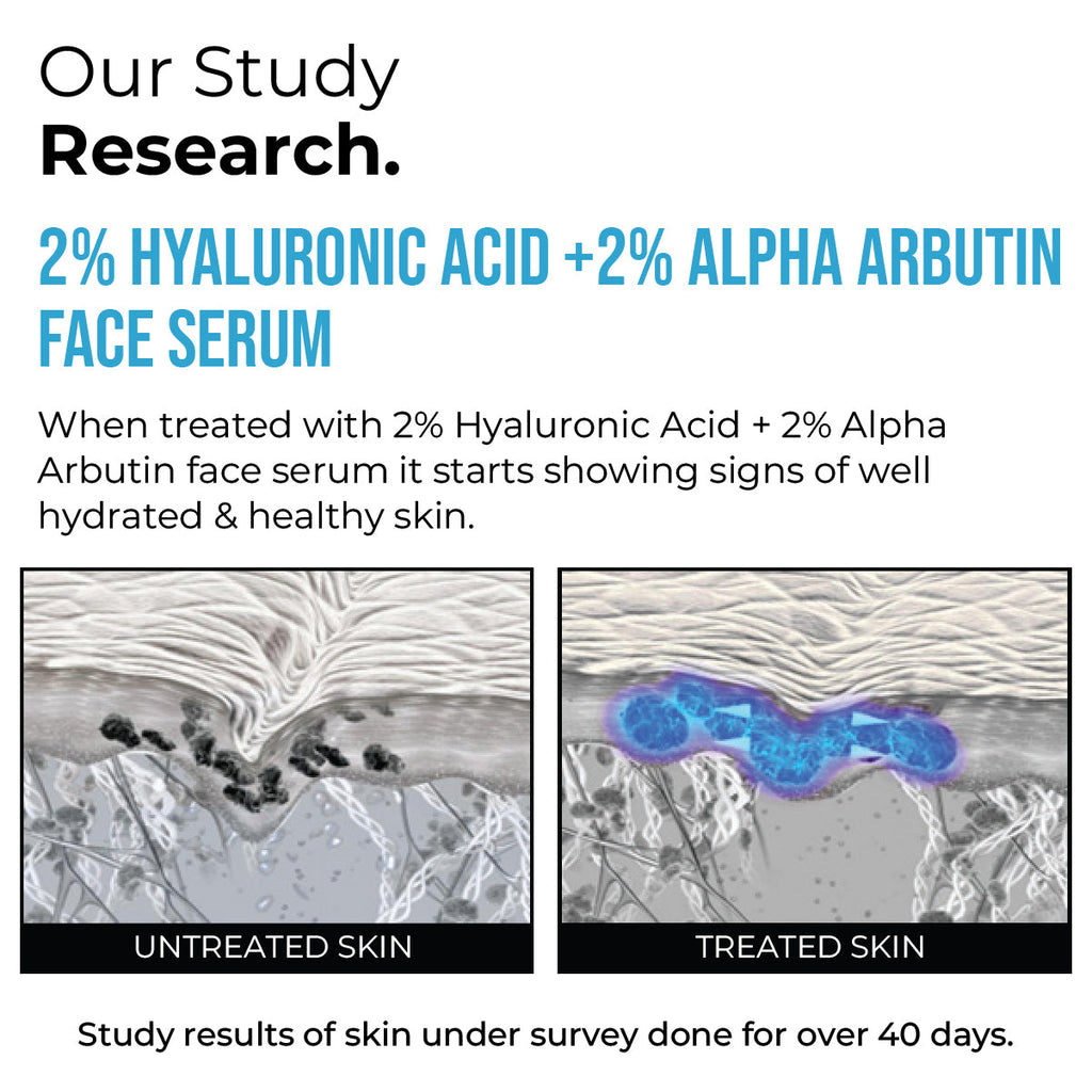 2% Hyaluronic Acid + 2% Alpha Arbutin Face Serum