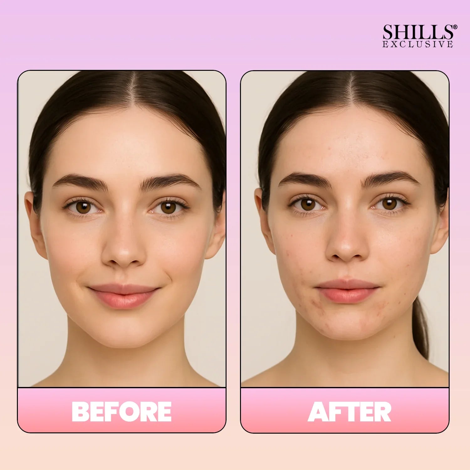 Makeup Remover Mist