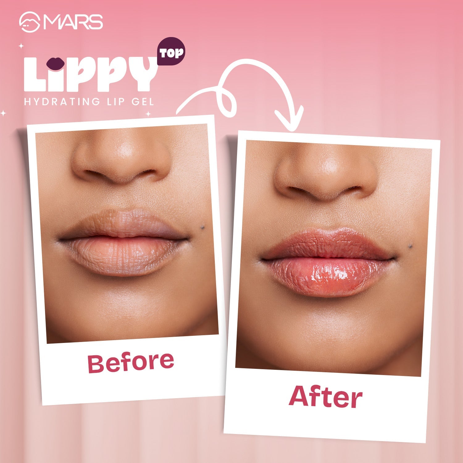 Lippy Top | Hydrating Lip Gel