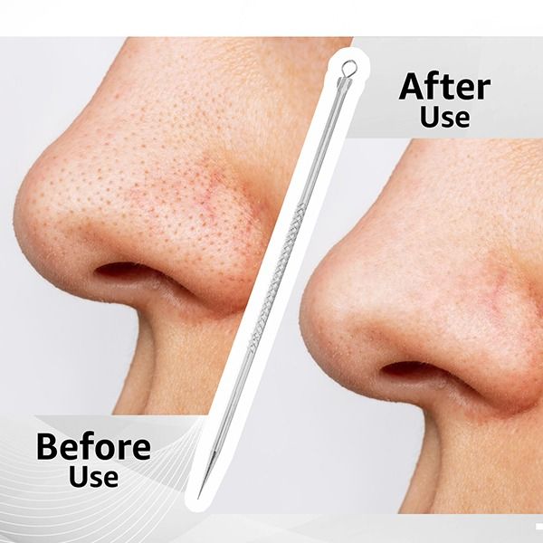 Blackhead Remover - Pointed - BHR-01