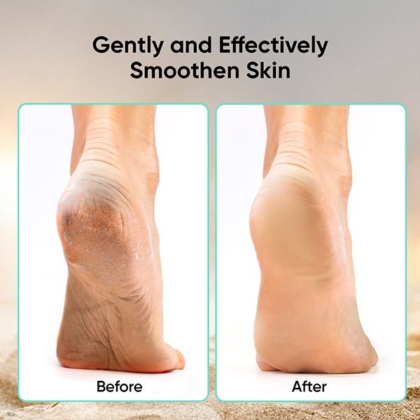 Foot Scrubber (4 in 1) - PD-02