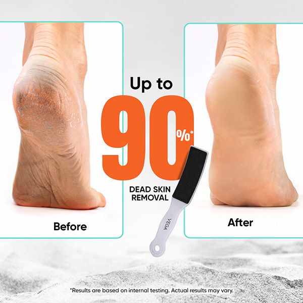 Foot File-PD-30